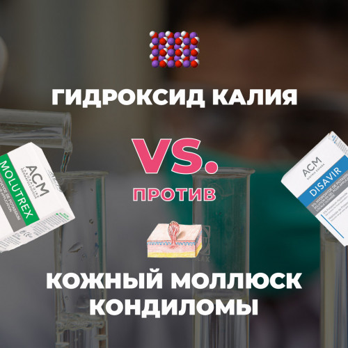 Кожный моллюск и кондиломы: лечение гидроксидом калия без боли и рубцов